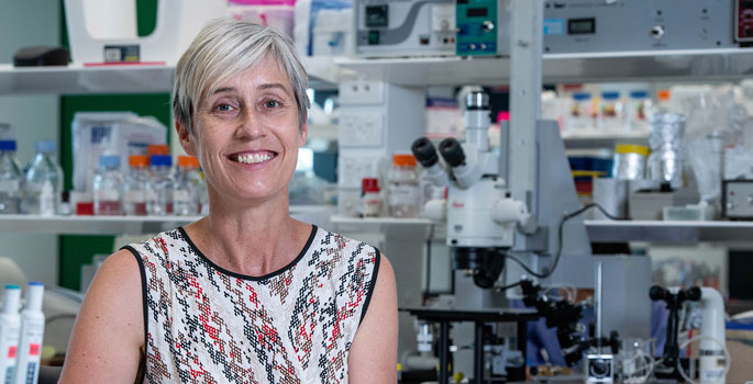Professor Claudine Bonder, Head Vascular Biology and Cell Trafficking Laboratory
